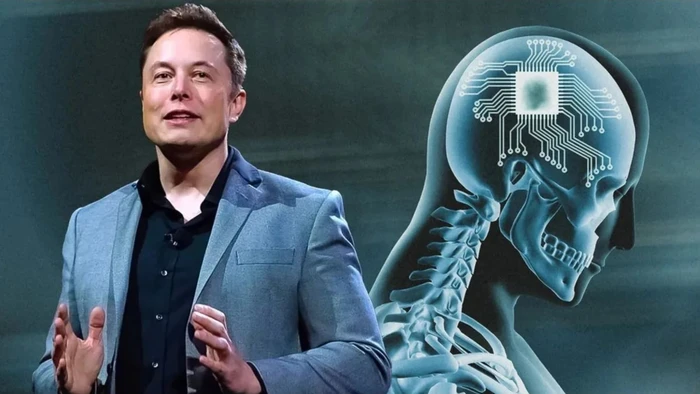 Elon Musk cùng Neuralink đưa chip vào não người: Mở ra cánh cửa tương lai?