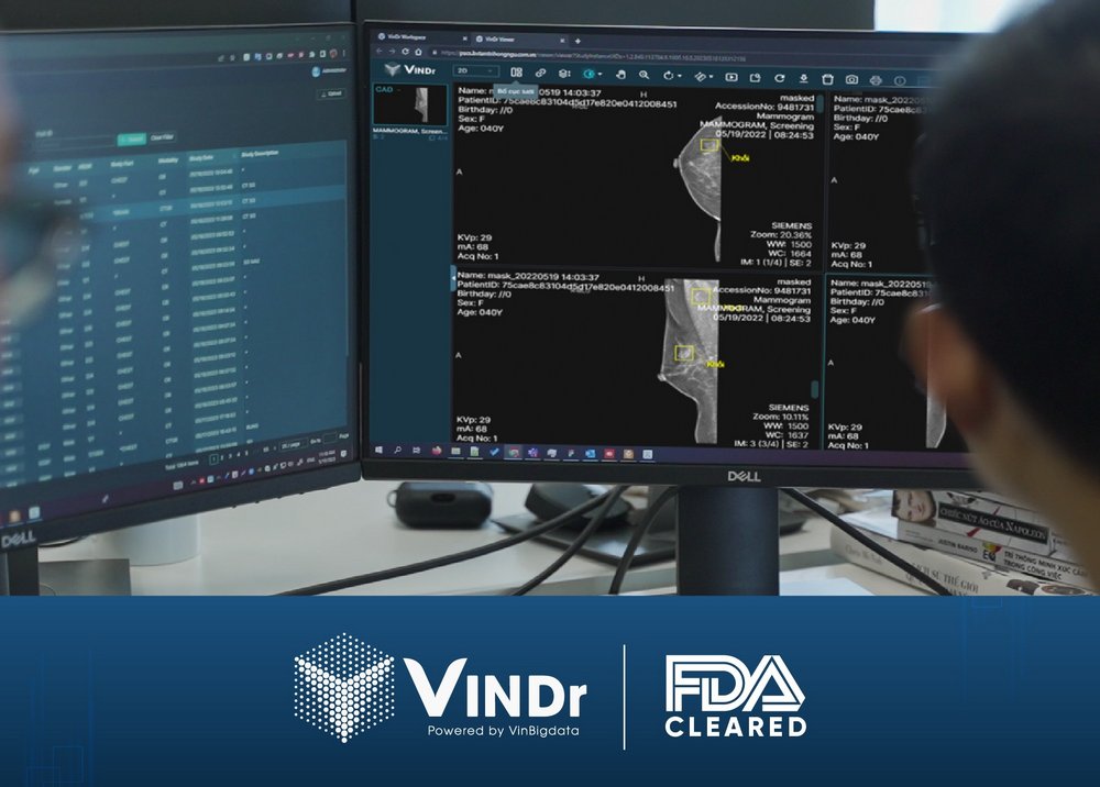 AI của VinBigdata đạt chứng nhận của FDA