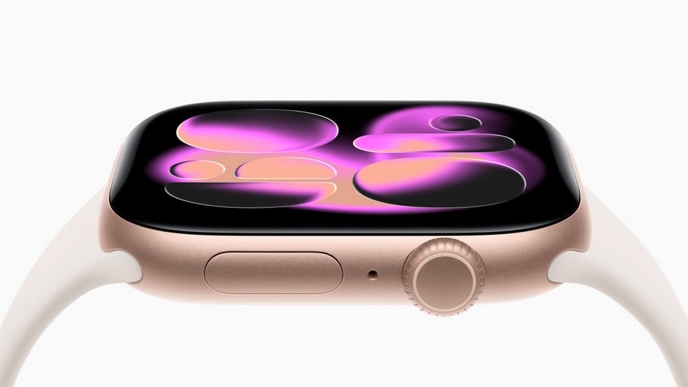 Apple Watch Series 11 cải tiến mạnh mẽ tính năng sức khỏe